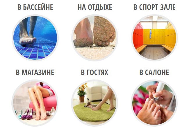 Где можно подцепить грибок
