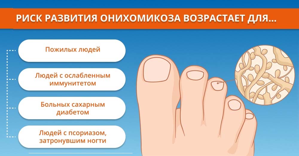Какие люди в зоне риска